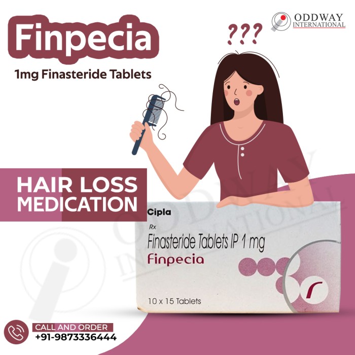 Finpecia 1 mg Giá - Viên nén Cipla Finasteride 1mg